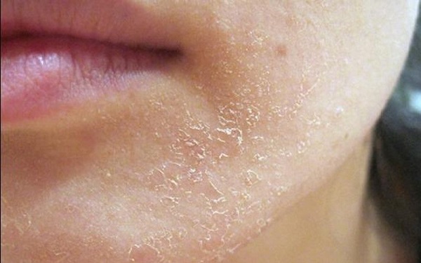 Hướng dẫn cách kiểm tra loại da mặt của bạn tại nhà 